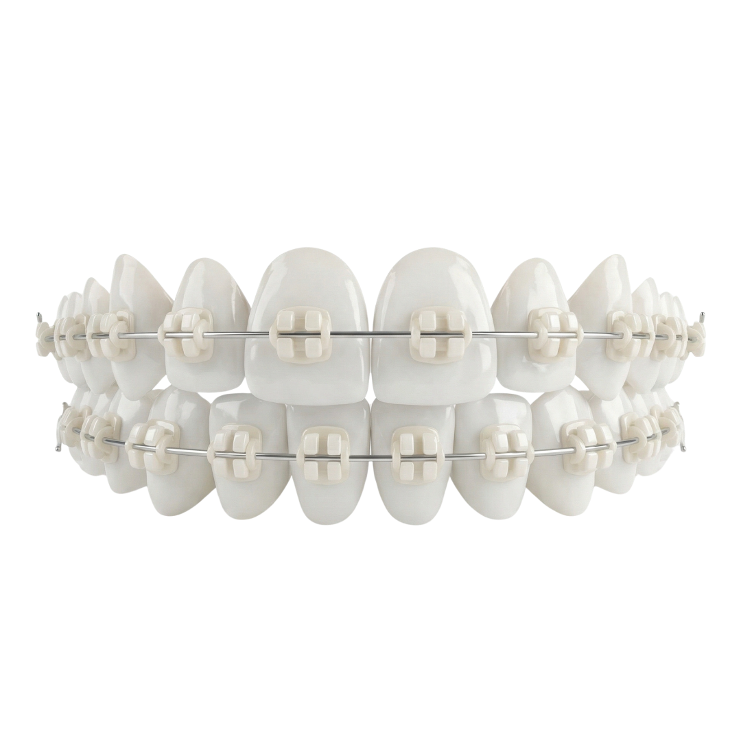 3D Ceramic Braces